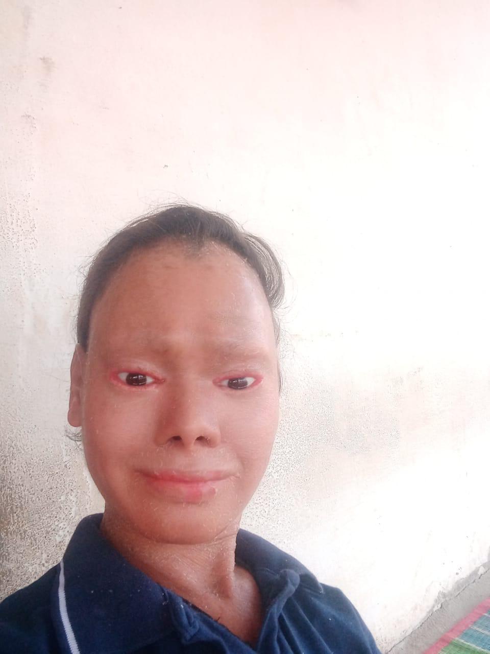 Close-up portrait of Shalini Yadav smiling after treatment.