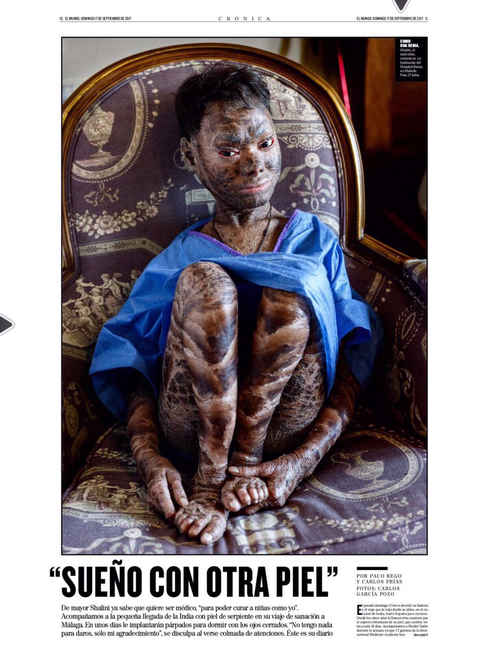 Spanish newspaper feature about Shalini Yadav headlined 'Sueño con otra piel'.